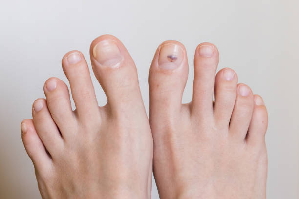 Foot & Nail Health